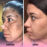 Turmeric Acid Cleaning Pads (40 Pieces)