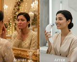 Deep Pore Cleaning Device – Facial Blackhead Remover Machine